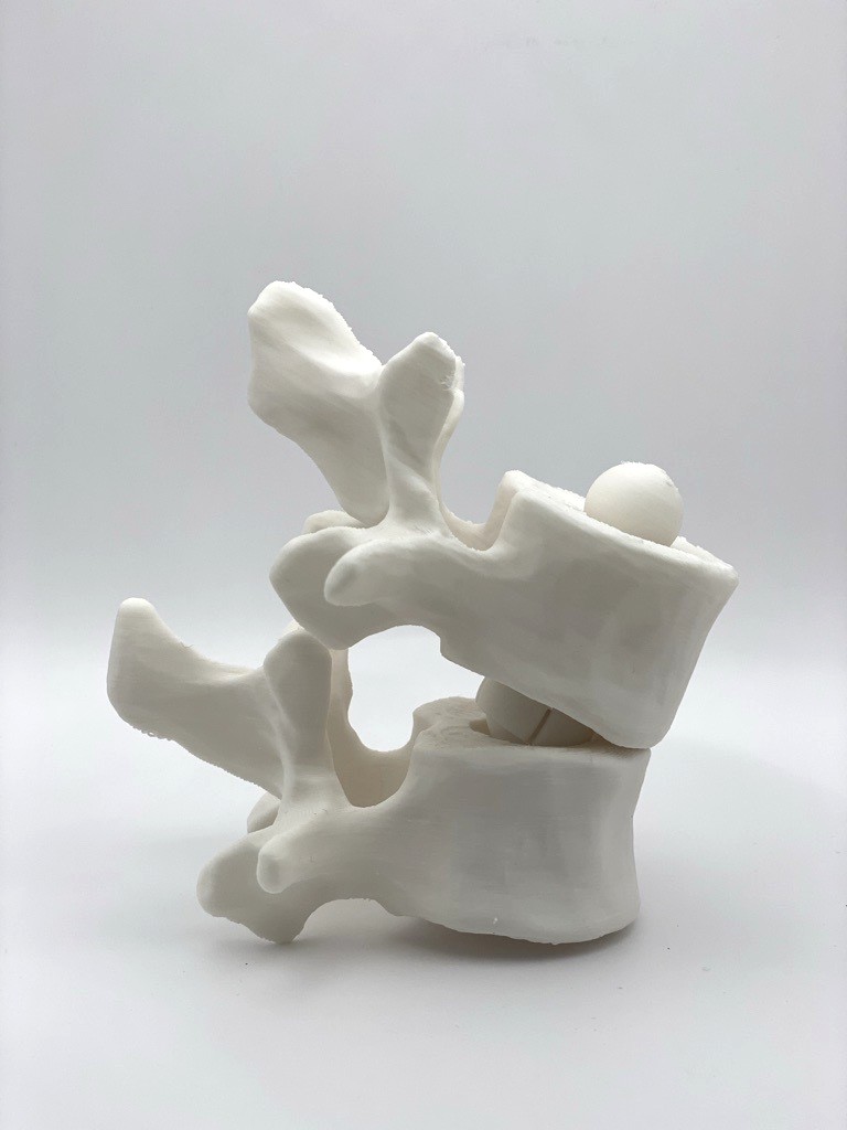 Filament polymère de grade médical PLA