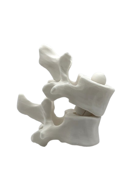 Zoom sur le PLA médical